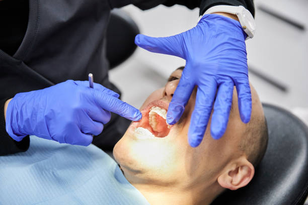 Best Emergency Tooth Extraction  in Fayetteville, NC