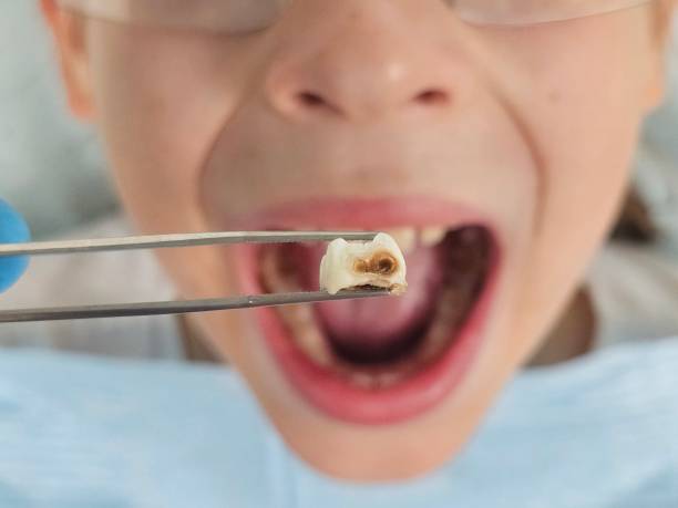 Best Emergency Pediatric Dentist  in Fayetteville, NC