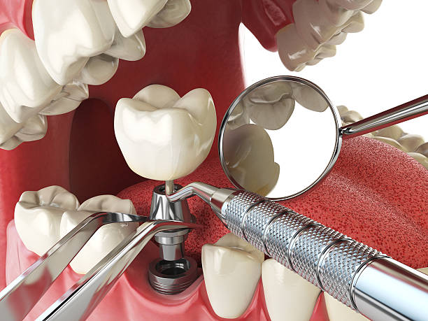 Best Tooth Infection Emergency Dentist  in Fayetteville, NC