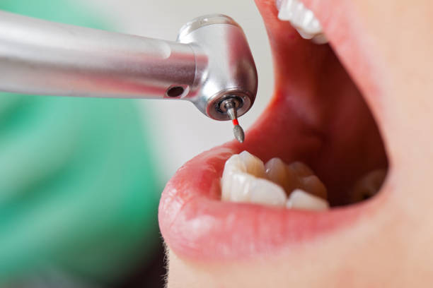 Best Dentist Open on Weekends  in Fayetteville, NC